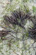 Furcellarian lumbricalis